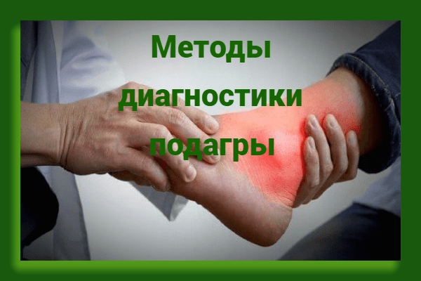 Методы диагностики подагры