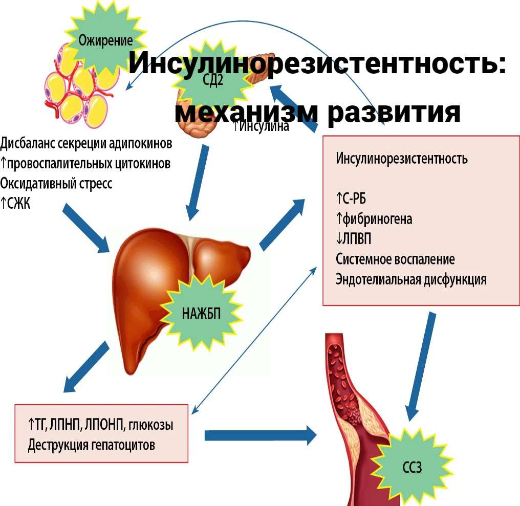 Инсулинорезистентность: механизм развития